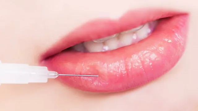 Sự thật ít ai biết của việc tiêm filler môi làm đẹp | VTV.VN
