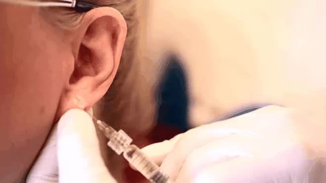 Tiêm tai tài lộc: Chuyên gia tiết lộ quy trình từ A đến Z