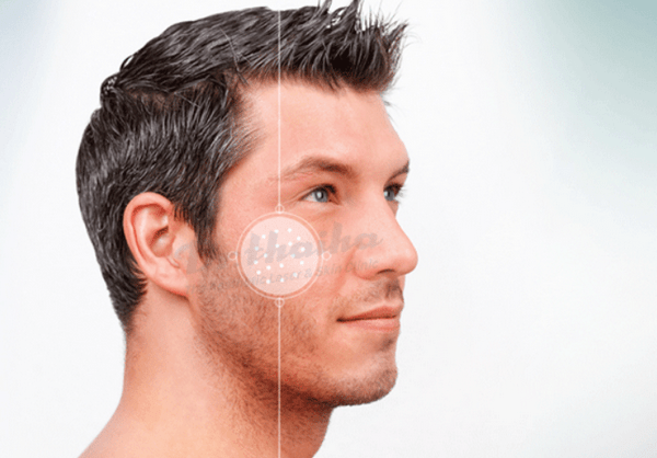 Cách làm căng da mặt cho nam giới an toàn hiệu quả nhất